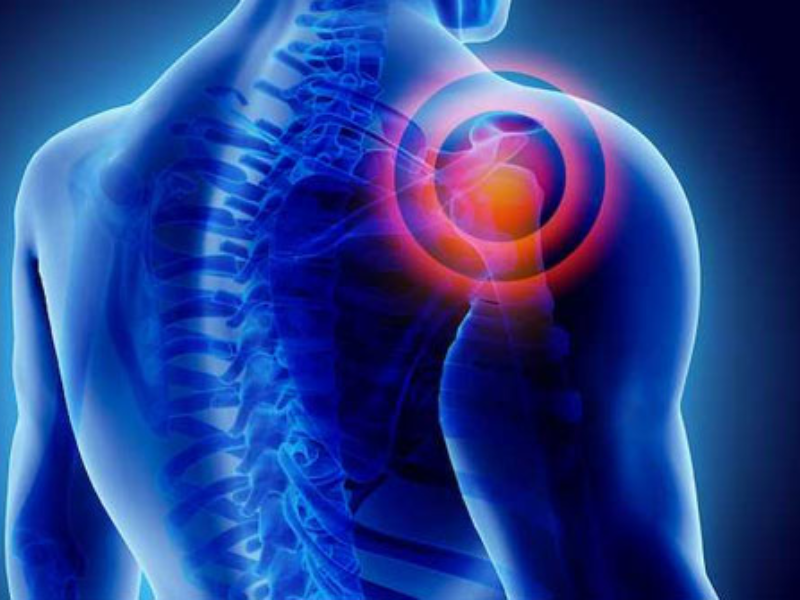 Slip Disc / Disc Bulge / Sciatica