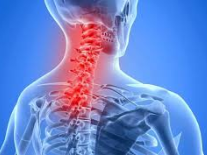 Neck Pain & Cervical Spondylosis