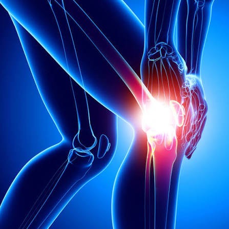 Knee Pain & Osteoarthritis